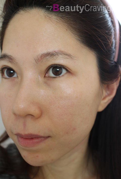 New York Skin Solutions