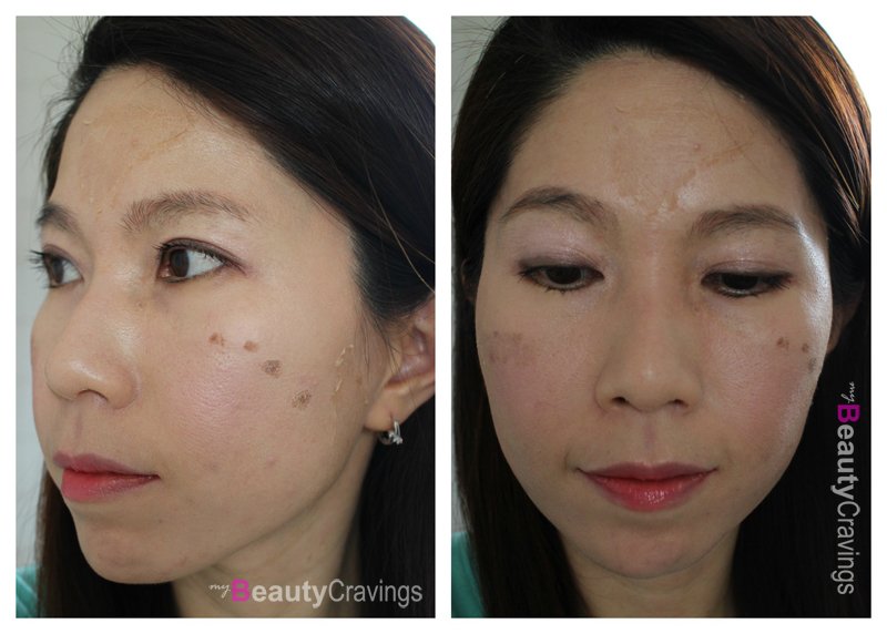 Day 7 - VI Precison Peel