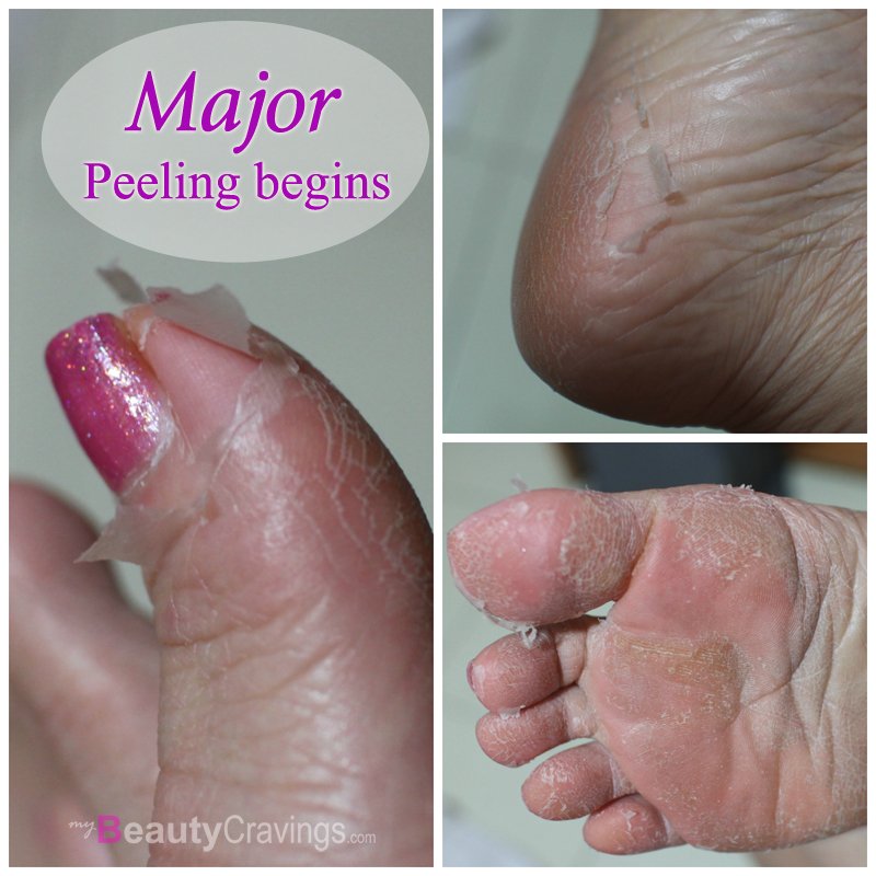 Skinlite Exfoliating Foot Mask
