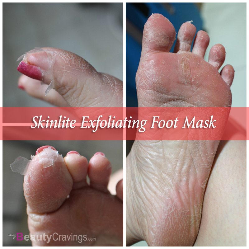 Skinlite Exfoliating Foot Mask