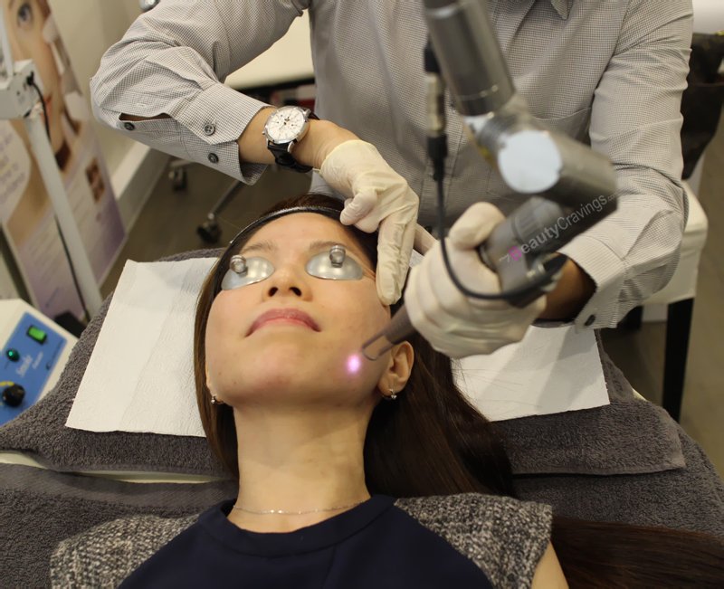 Laser Facial (Gangnam Laser Clinic)