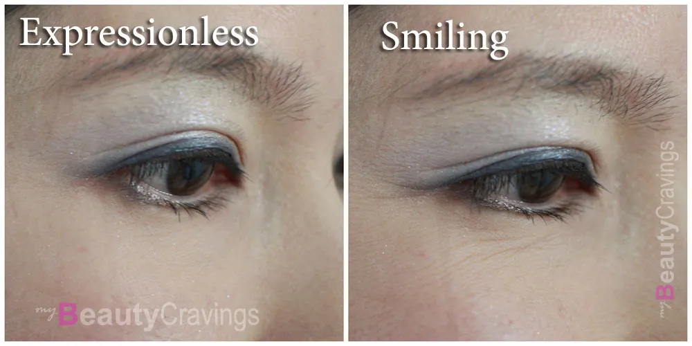eye wrinkles while smiling