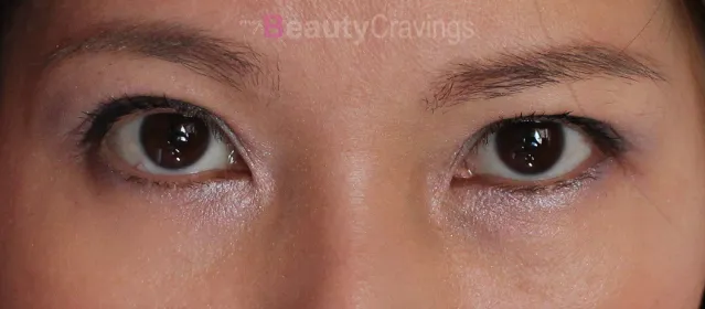 shiseido white lucent dark circles