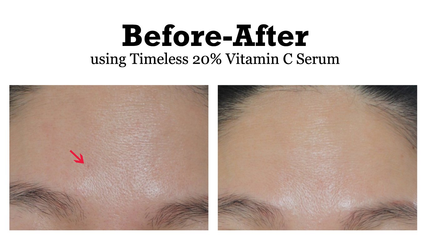 Timeless 20% Vitamin C Serum